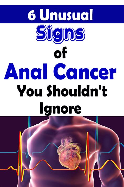 6 Unusual Signs Of Anal Cancer You Shouldnt Ignore