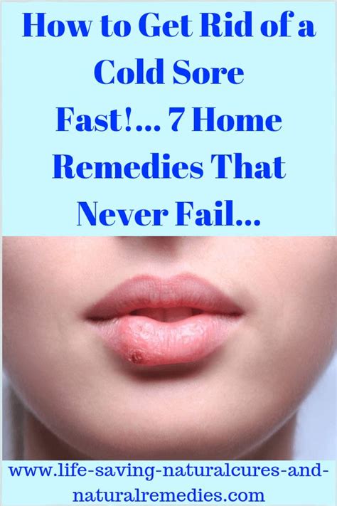 best natural remedies and home treatment options for fever blisters and cold sores home