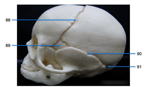 Fetal Skull Sutures And Fontanelle Lateral View Diagram Quizlet