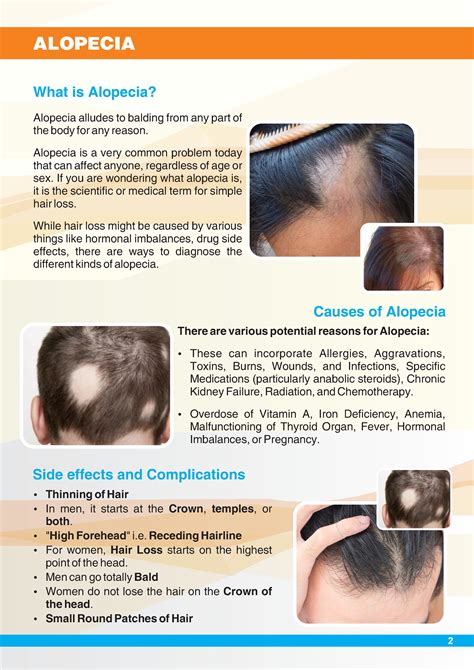 What Is Alopecia Hair Loss Typescausesdiagnosis And Treatment By Looks Forever Hair And