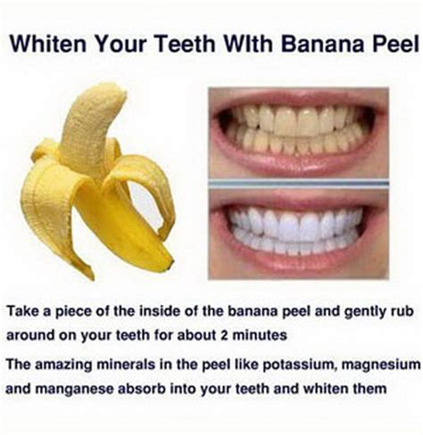 15 Natural Ways To Whiten Your Teeth Homemade Teeth Whiteners Just