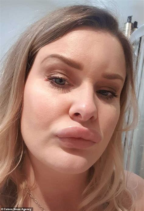 Mother Unrecognisable As Skin Reactions Leave Her Looking Like She