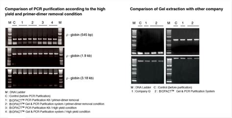 Biofact™ Gel And Pcr Purification System 100 Prep Smartscience