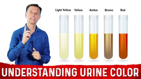 What Urine Color Indicates About Your Body Drberg Youtube