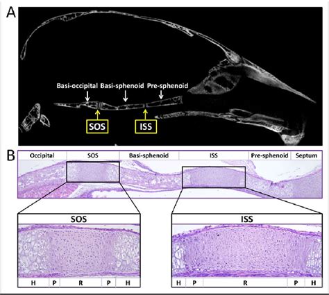 Cranial Base Synchondrosis The Positioning Of The Maxilla Anterior