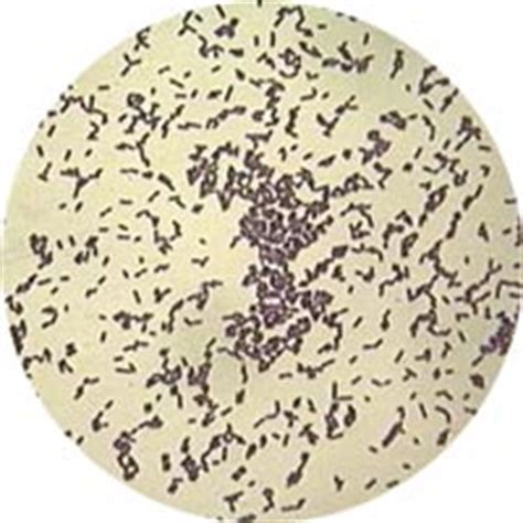 It is a facultative anaerobic bacterium, capable of surviving in the presence or absence of oxygen. Listeria. Causes, symptoms, treatment Listeria