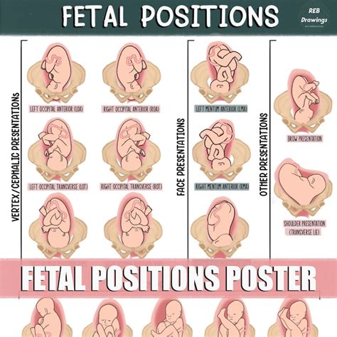 fetal postions in the uterus poster etsy