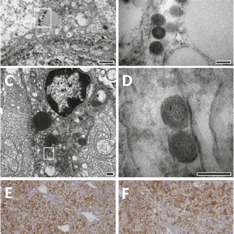 Microfibrillar Intranuclear Viral Inclusion Bodies Are Prominent In