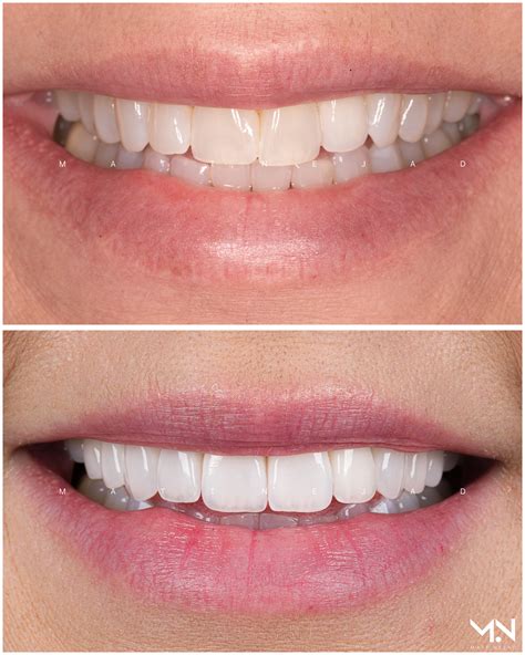 Cosmetic Dentistry Before And After Photos Helm Nejad Stanley