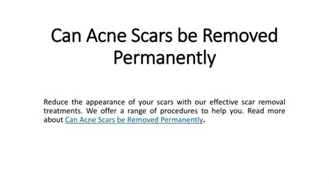 Ppt Can Acne Scars Be Removed Permanently In Dubai Powerpoint