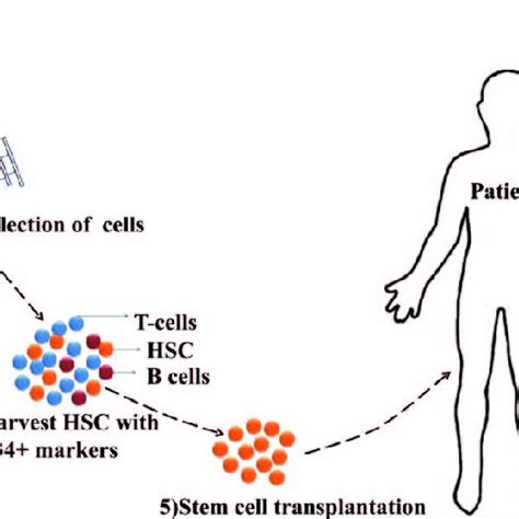 Allogeneic Stem Cell Transplantation Download Scientific Diagram