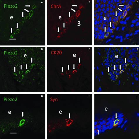 Merkel Cells Are Not All Piezo2 Positive Piezo2 Was Detected In Most