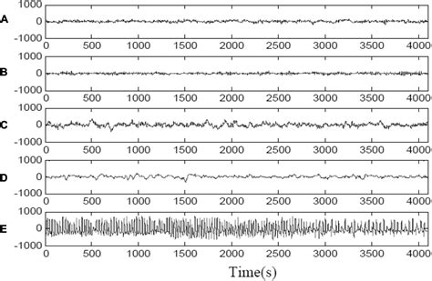 Frontiers Noise Robustness Low Rank Learning Algorithm For Electroencephalogram Signal