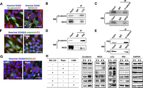 Autophagy Promotes The Degradation Of β Catenin And Nicd A