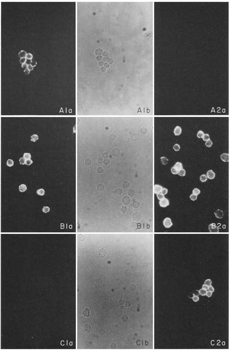 Figure I From DIFFERENTIATION OF T CELL PRECURSORS IN NUDE MICE