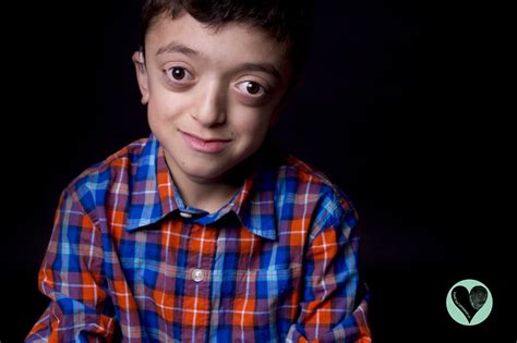 I Photograph Children With Rare Diseases To Encourage People To Look