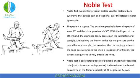 Noble Test For Iliotibial Band Syndrome