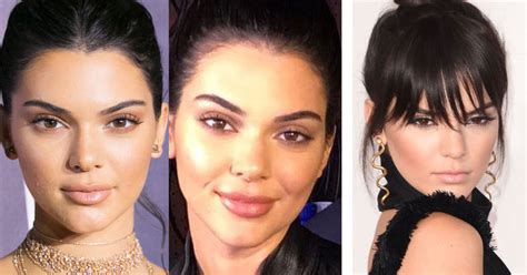 Do You Think Kendall Jenner Has Had Lip Injectionsany