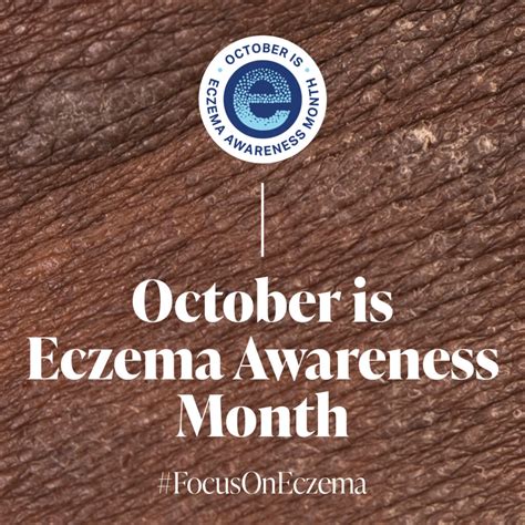Eczema Awareness Month Assets National Eczema Association