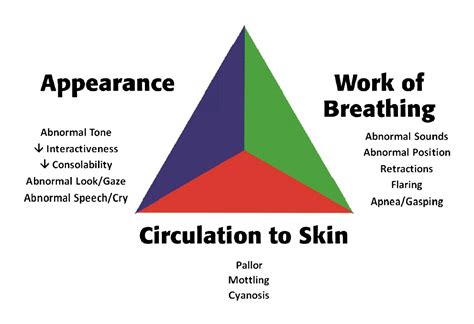 The Pediatric Assessment Triangle Accuracy Of Its Application By