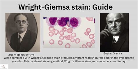 Wright Giemsa Stain Procedure Principle And Results