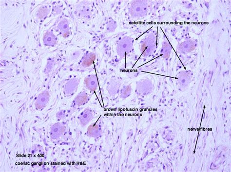 Pin On Histology Spinal Cord And Ganglion
