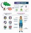 What are the symptoms of Lyme disease? - AONM Health Hub