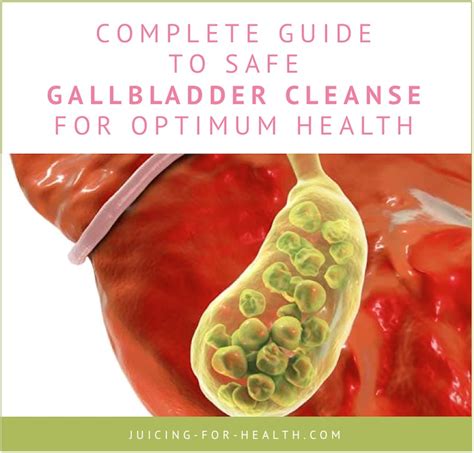 How To Cure Gallbladder Stones In Natural Way Colman Hisdow