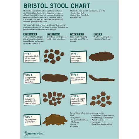 Bristol Stool Chart Laminated Poster Of Bristol Stool Chart Antomystuff