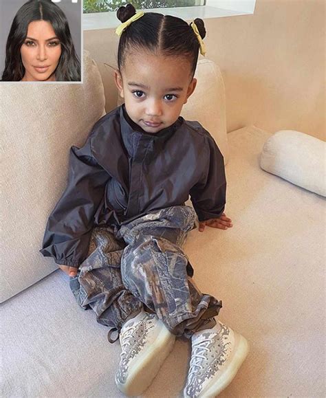 Kim Kardashian On Why Daughter Chicago 2 Had To Get Stitches