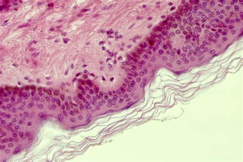 Stratified Squamous Epithelium Location 819 The Best Porn Website