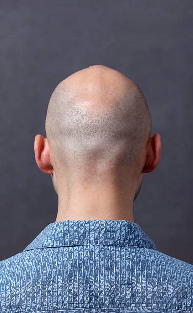 Bald Head Back Stock Photos Pictures And Royalty Free Images Istock