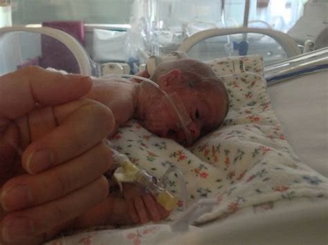 Baby Is Born 16 Weeks Early 84 Pics