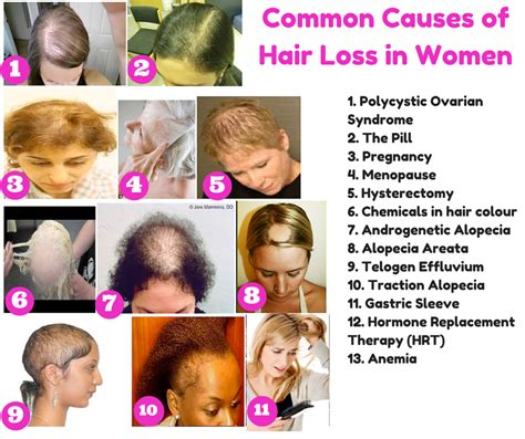 Causes Of Hair Damage Rijal S Blog