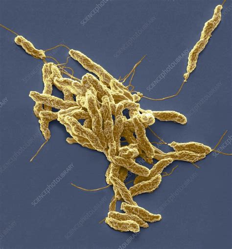 Campylobacter Jejuni Bacteria Sem Stock Image C0286256 Science