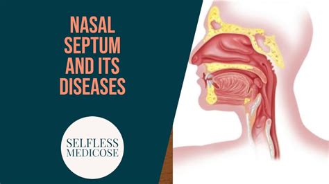 NASAL SEPTUM And DISEASES Part Septal Abscess YouTube