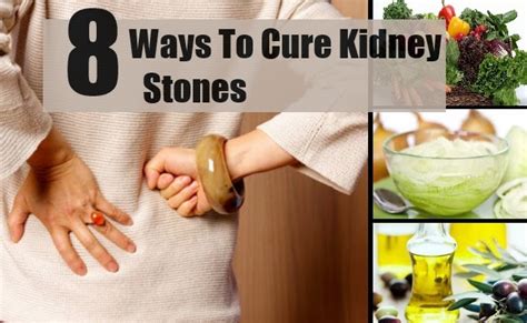 8 Ways To Cure Kidney Stones Mzizi Mkavu