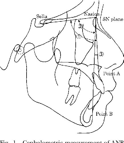 Figure 1 From Three Dimensional Relationship Between Pharyngeal Airway
