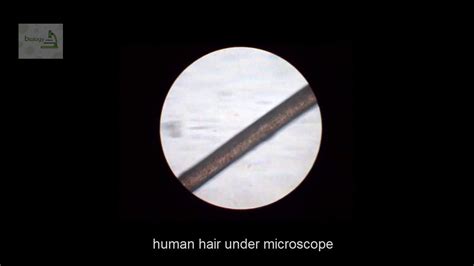 Human Hair Electron Microscope Gloria Joy Victor 1 Electron