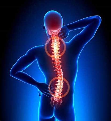 Back Pain Causes Symptoms And Treatment
