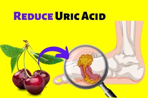 Top 10 Foods To Reduce Uric Acid Levels Fast