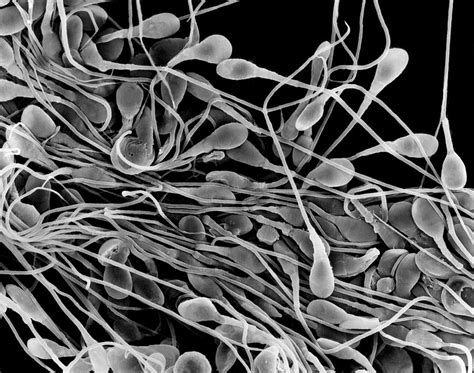 human sperm photograph by dennis kunkel microscopy science photo library