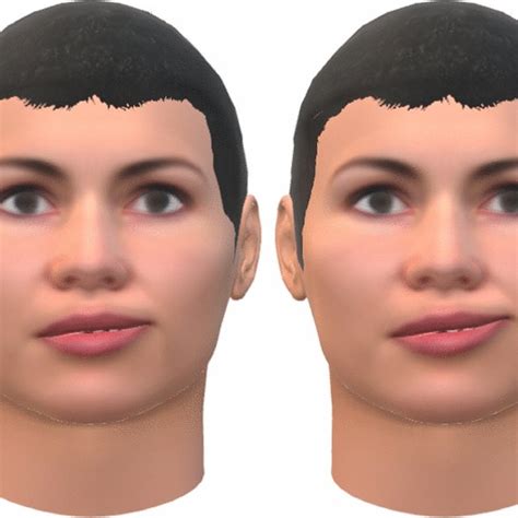 Stroke Symptom Facial Drooping Animation With The 3d Face Model