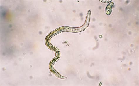 Signs Symptoms And Side Effects Of Parasites The Nhcaa