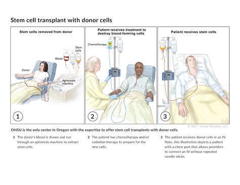 Understanding Stem Cell Transplants Knight Cancer Institute Ohsu