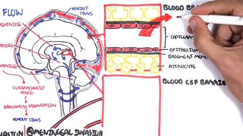 Bacterial Meningitis Pathophysiology Youtube