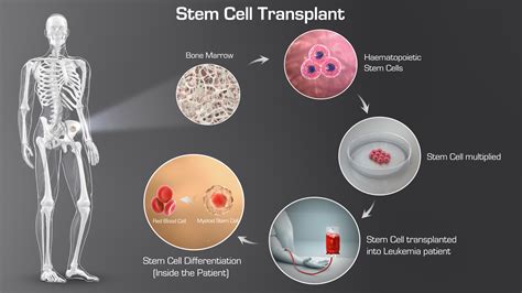 Stemcelltransplant Iow Scientific Animations