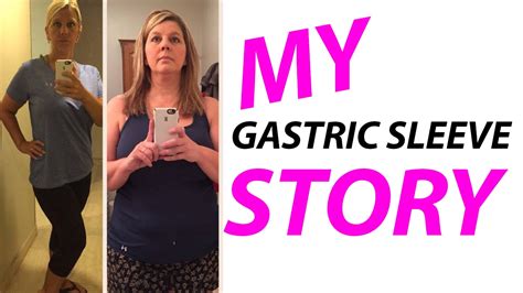 Gastric Sleeve Surgery Success Stories With Before And After Photos