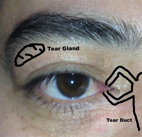 What Is Tear Duct Surgery