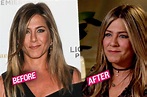 More Plastic Surgery? Jennifer Aniston Gets Fillers For Plumper Cheeks ...